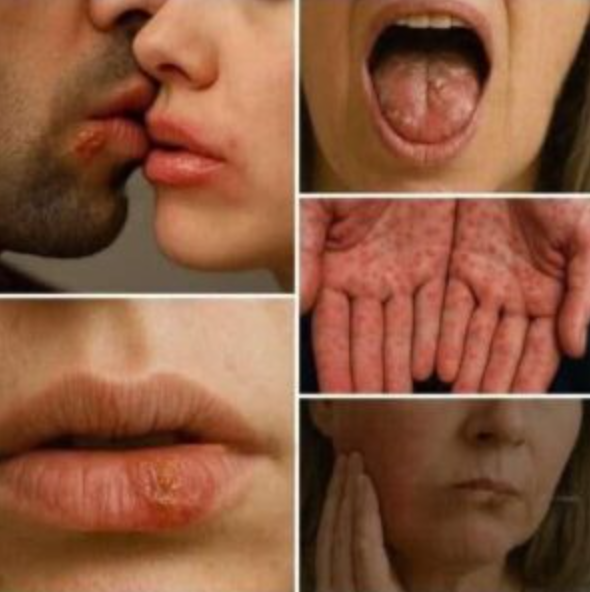 Don’t Underestimate It: Recognizing The Early Signs Of Oral Can…
