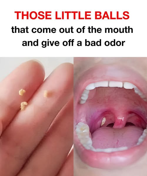 Bad breath: a home remedy to get fresh breath