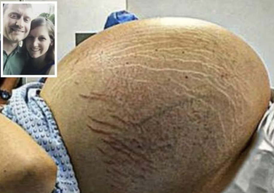 Mom Goes To Hospital Thinking She’s Having Twins, Then Doctor Discovers Something Incredible