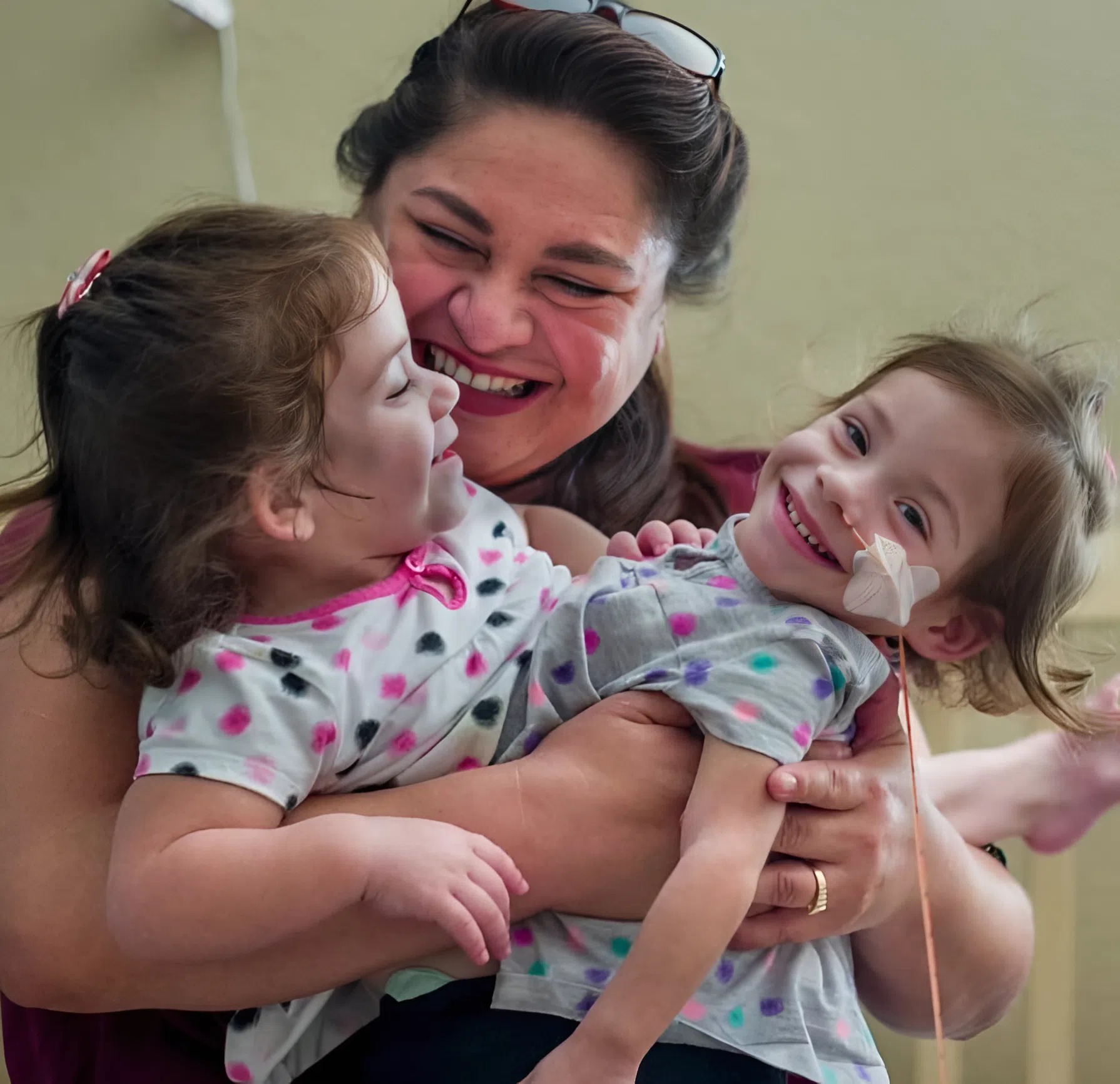 The twin sisters were born joined at the chest and shared vital organs: here’s what the sisters look like after separation