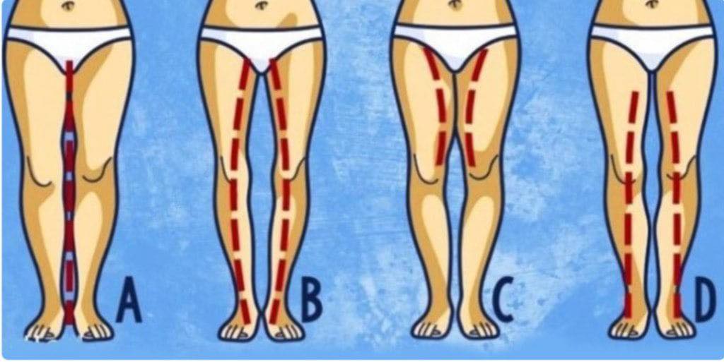 Silent Warnings In Her Legs