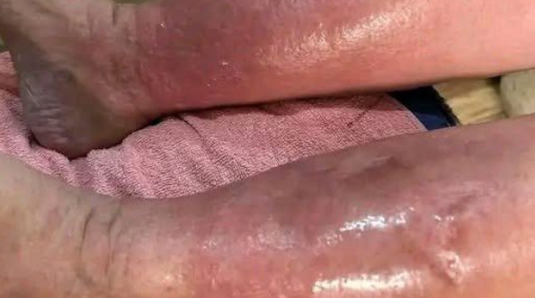 One Month Before A Heart Attack, Your Feet Will Warn You Of These 6 Signs!