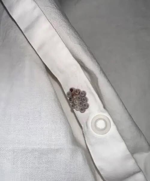 I found these tiny balls in my bed and nearly had a heart att.ack: here’s what they were.