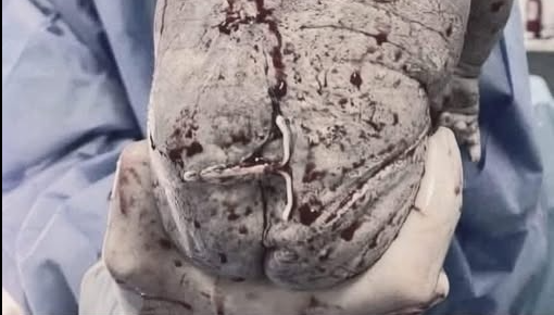 SOTD – The Baby Who Defied Birth Control! A Viral Story of Fate and Surprise