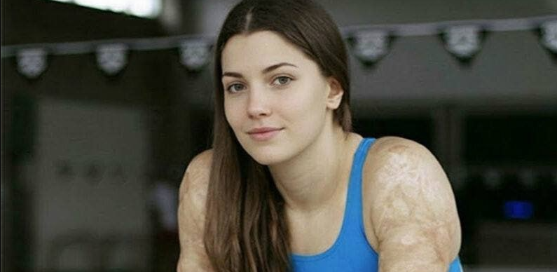 SOTD – These are the consequences of sleeping co! See now