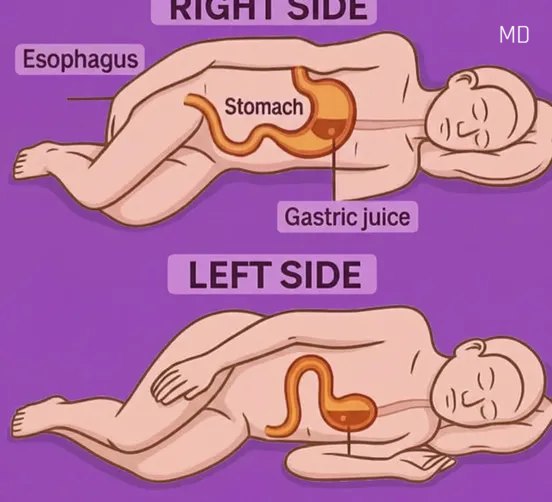 A Simple Change in Sleeping Position That May Improve Your Comfort and Health!