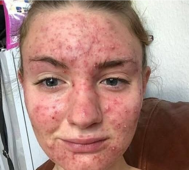 Her body was itching, I thought it was an allergy!