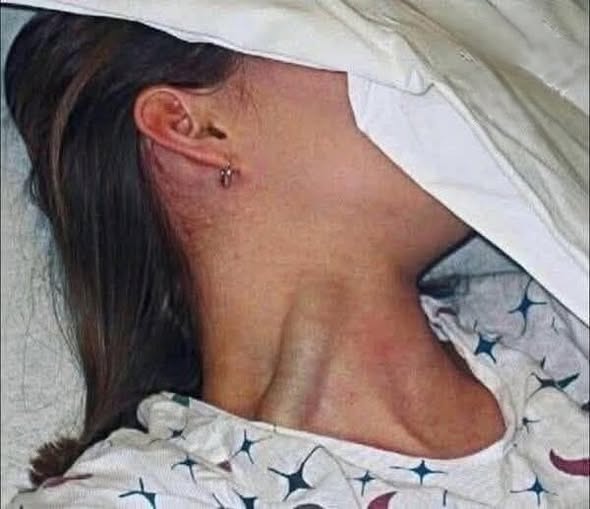 SENSATIONAL TRAGEDY Young Woman Loss Sparks Massive Global Conversation On Hidden Health Dangers