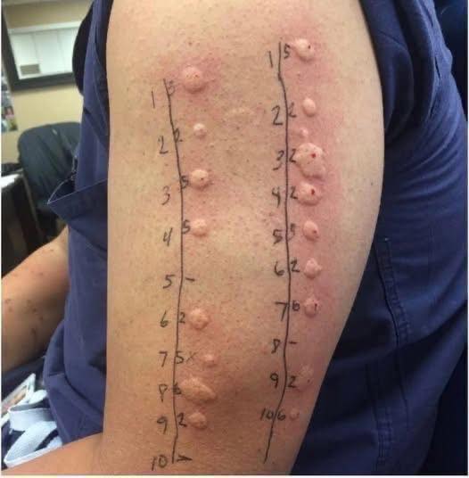 SILENT KILLER IN YOUR MOUTH Why Ignoring These Minor Symptoms Could Be Your Biggest Mistake