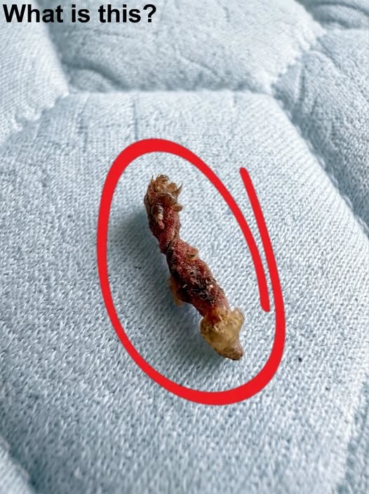 I woke up feeling like something was biŧing my upper back.