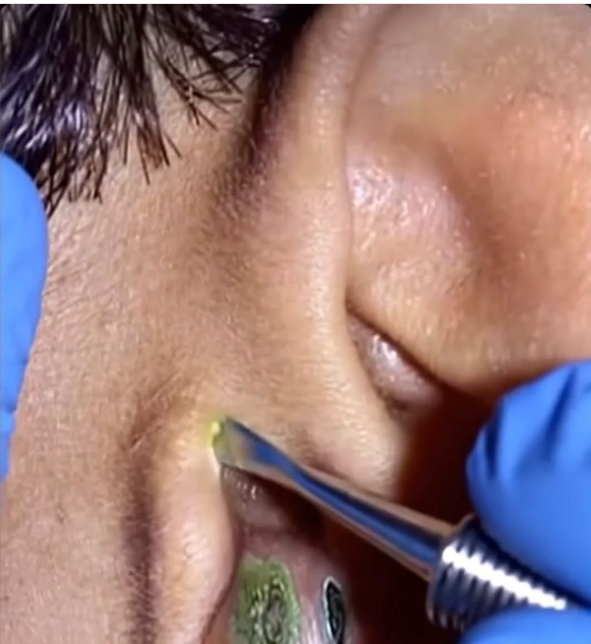 10 Signs Showing Something Is Wrong in Your Body