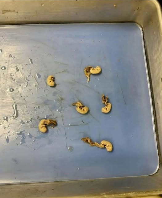 DEATH IN THE BAG WHY YOUR FAVORITE HEALTHY SNACK IS SECRETLY POISONING YOUR ENTIRE FAMILY