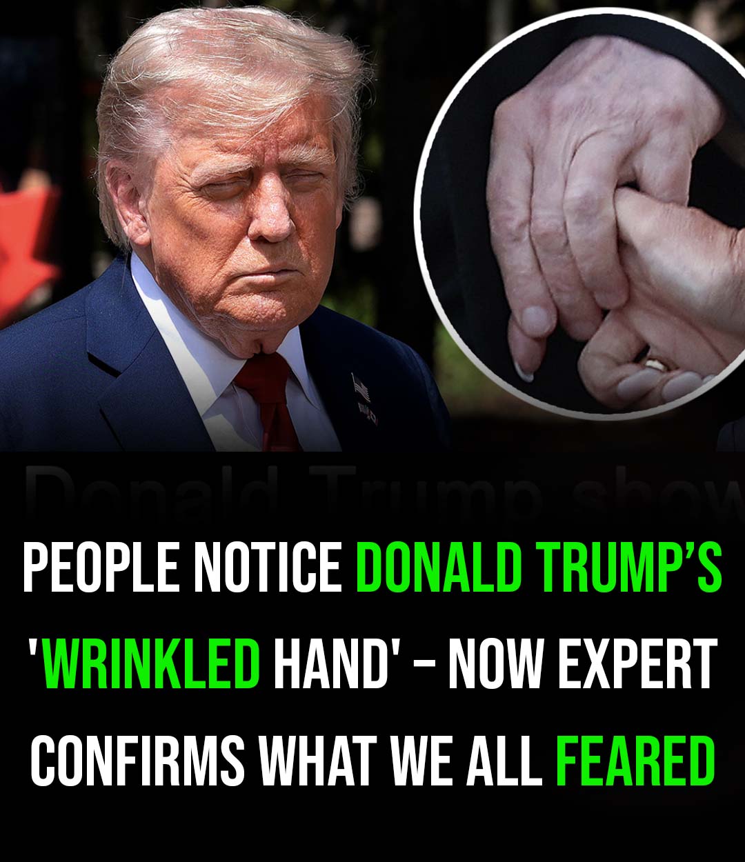 Trump shows off ‘wrinkled hands’ amid latest health fear