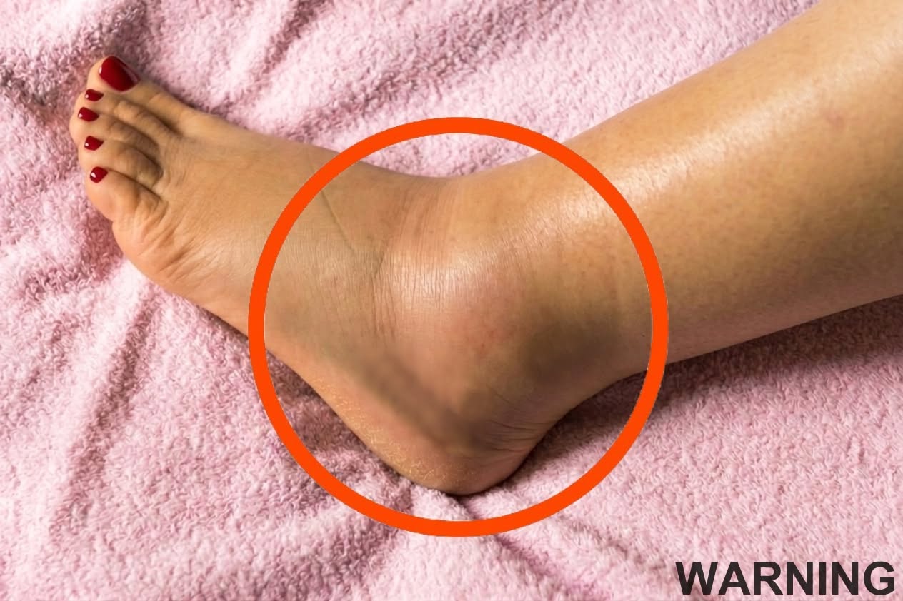 If you notice your legs are swollen, that’s a sign of ca…