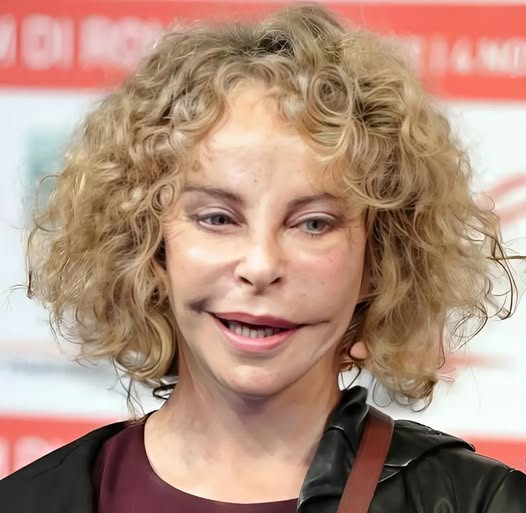 Hollywood Blonde Bombshell Ruined By Plastic Surgery Leaves Devoted Fans In Utter Disbelief