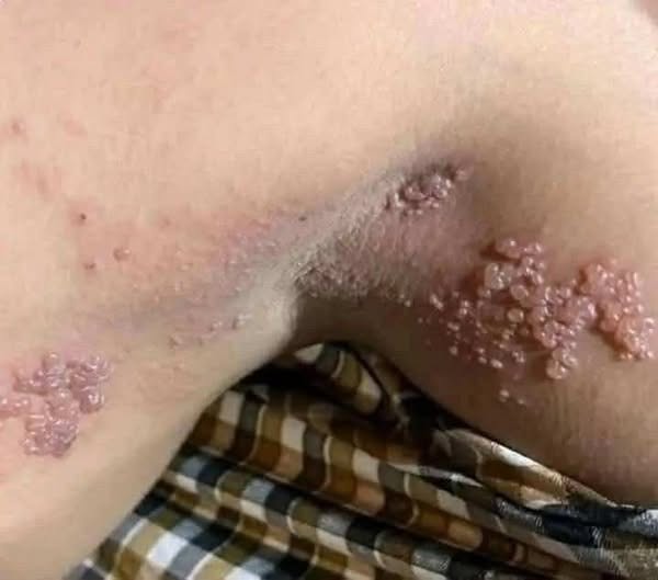 These are the consequences of sleeping co – See now!