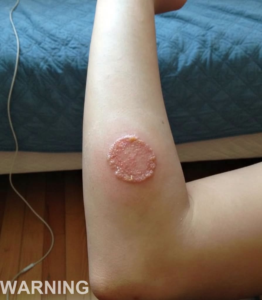 These are the consequences of sleeping with the…