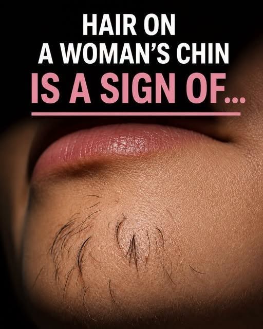 Why Chin Hair Grows in Women and What It May Indicate