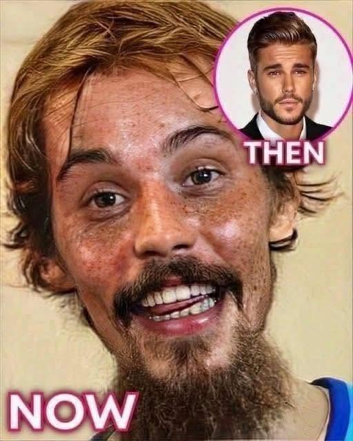 Justin Bieber admits that he tested positive for…