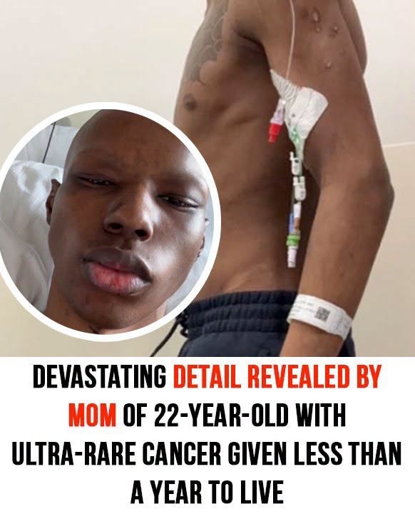 22-year-old told he has less than a year to live after stomach pain reveals ultra-rare cancer