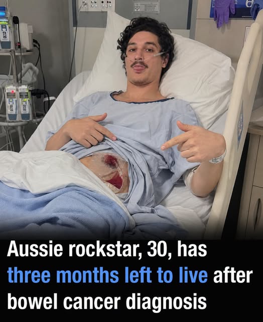 Aussie rockstar, 30, has three months left to live after bowel cancer diagnosis