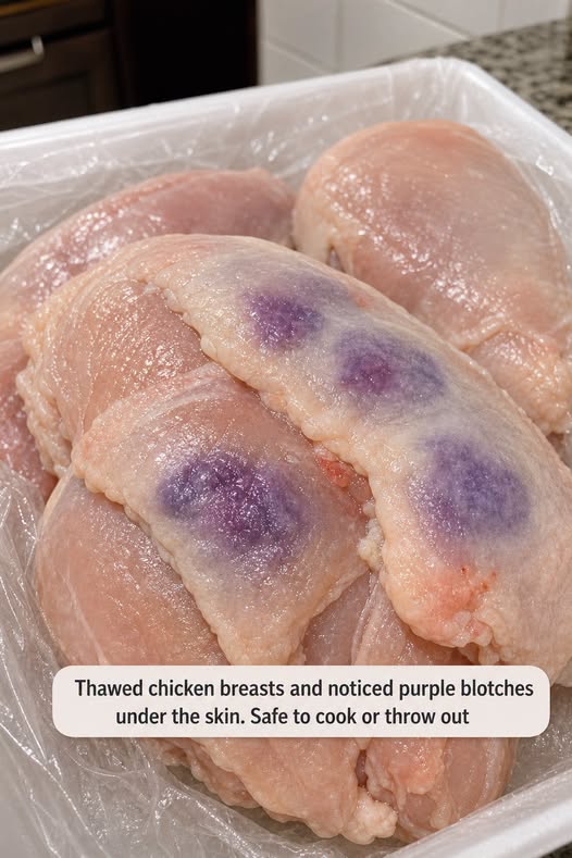 Thawed chicken breasts and noticed purple blotches under the skin. Safe to cook or throw out